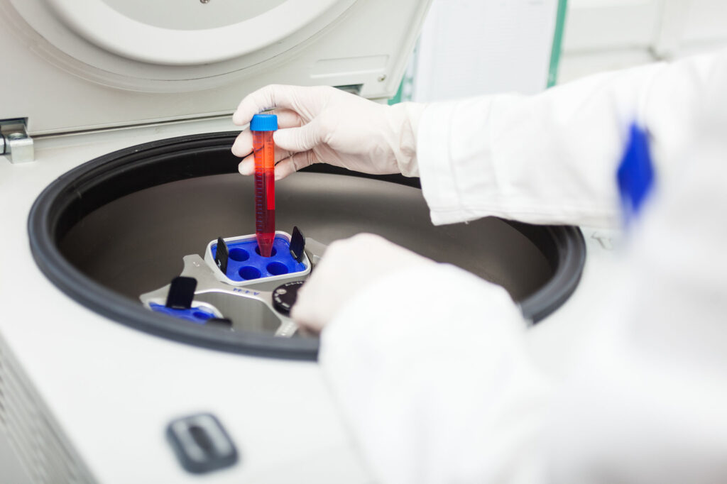 What Medical Processes Need Centrifuges?