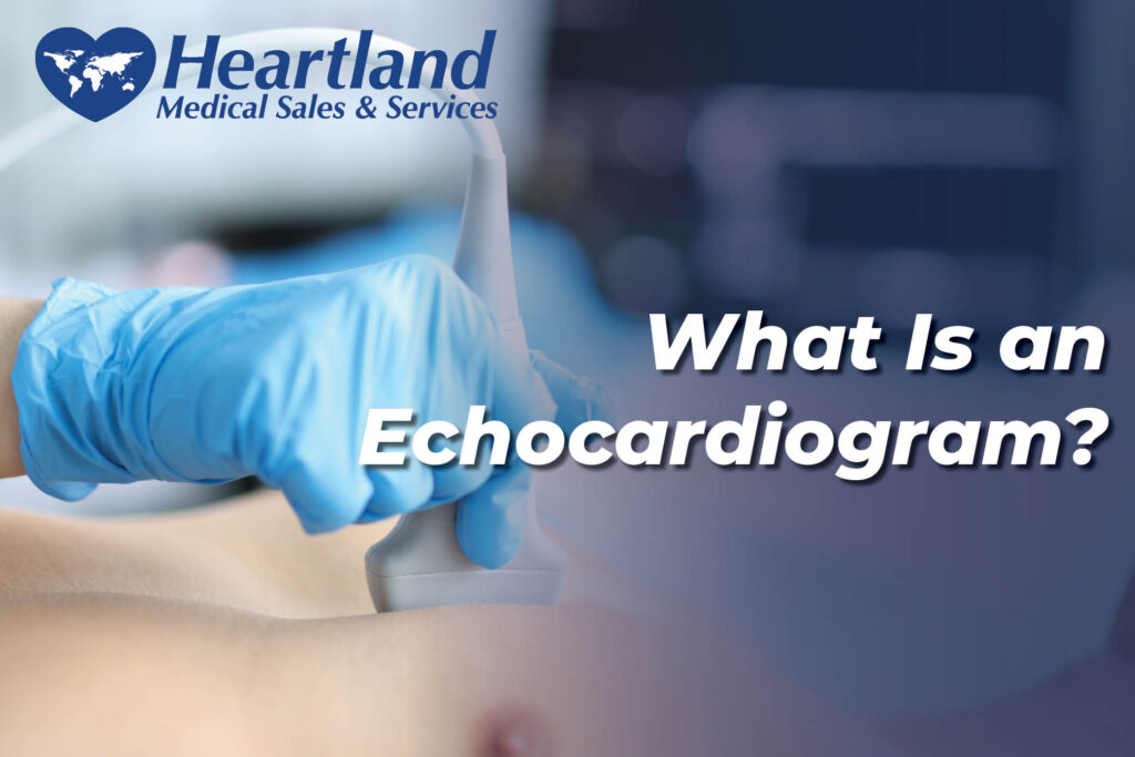 What Is an Echocardiogram?